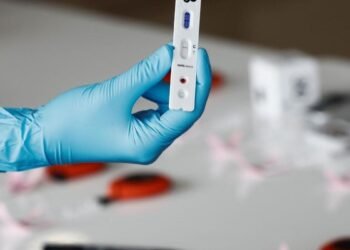 Coronavirus en Argentina: confirmaron 32 muertes y 3.478 contagios en las últimas 24 horas