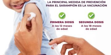 Sarampión: Estrategias para fortalecer la vigilancia y la vacunación antes del Mundial