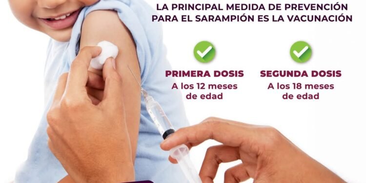 Sarampión: Estrategias para fortalecer la vigilancia y la vacunación antes del Mundial